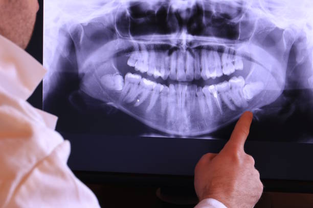 Best Knocked-Out Tooth Emergency  in Mcdonald, PA